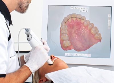 intra oral dental scanner intra oral dental scanner